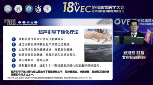 聚桂醇微創(chuàng)硬化治療技術(shù)學(xué)術(shù)推廣會(huì)六會(huì)同開，軟件助力數(shù)字化診療